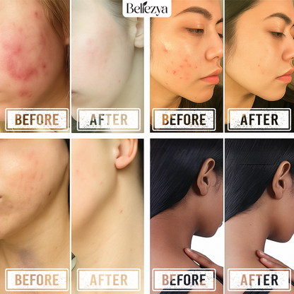 Toner with Glycolic Acid(25%OFF)